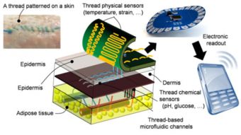 智能縫合技術(shù) 實時監(jiān)控傷口恢復(fù)狀態(tài)并連接手機(jī)的新突破